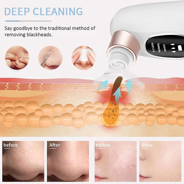 💧 Mini Hydra Facial Device – Portable Skin Rejuvenation & Deep Hydration Machine ✨